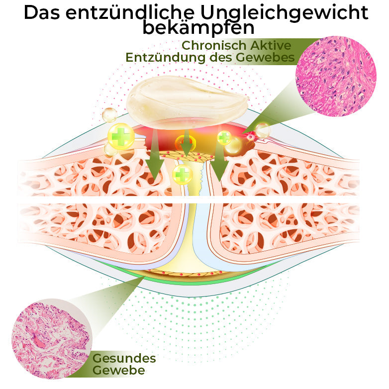 GFOUK™ CroCare Krokodilöl Gelenktherapie-Balsam