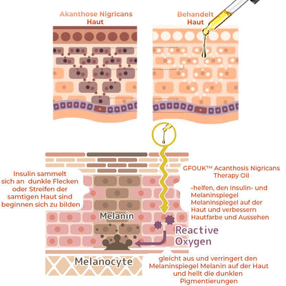 GFOUK™ Body Restore Kojisäure-Therapieöl