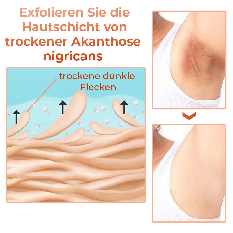 GFOUK™ Body Restore Kojisäure-Therapieöl