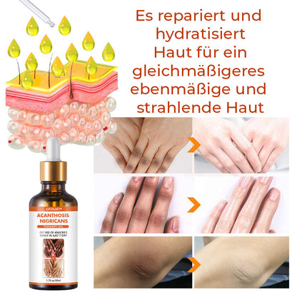 GFOUK™ Body Restore Kojisäure-Therapieöl