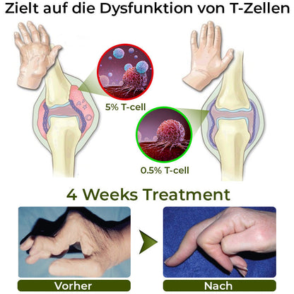 GFOUK™ CroCare Krokodilöl Gelenktherapie-Balsam